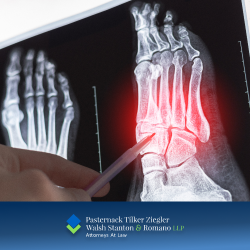 A doctor points at an x ray of a foot injured in a work accident in Brookhaven, NY